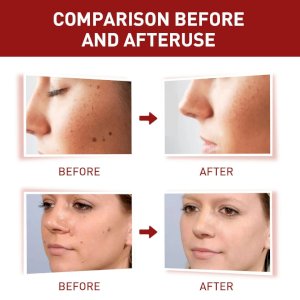 Essential Oil Spot Remover, Spot Remover and Corrector